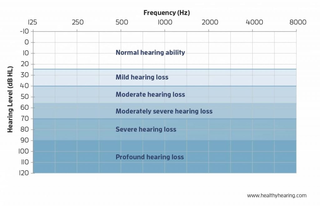 How To Read The Audiogram By Yourself AZ Hearing