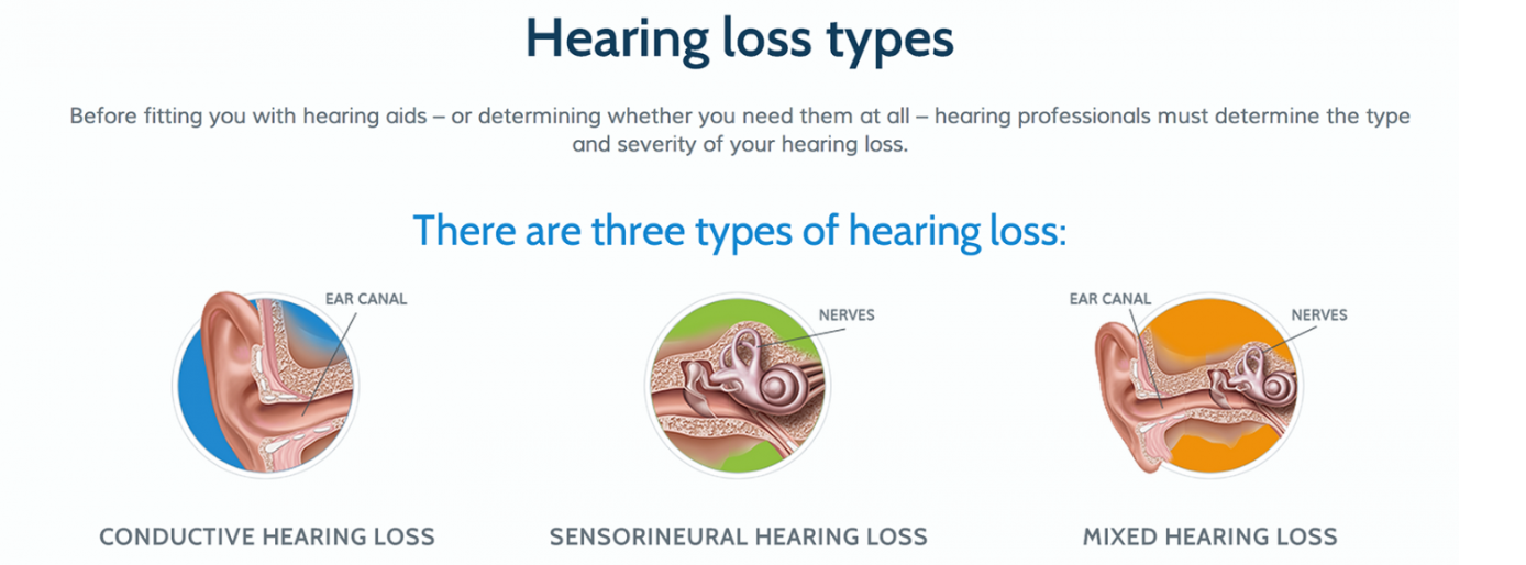 Types Of Hearing Loss And Corresponding Audiograms Az Hearing