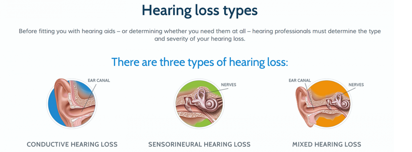 Types Of Hearing Loss And Corresponding Audiograms AZ Hearing